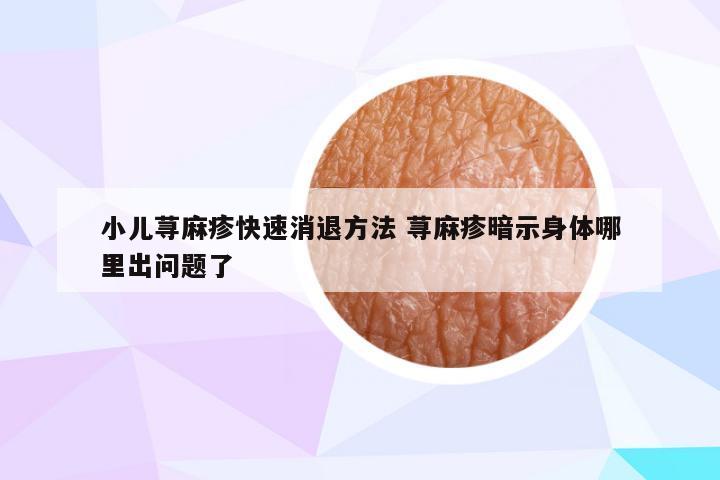 小儿荨麻疹快速消退方法 荨麻疹暗示身体哪里出问题了