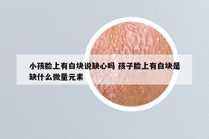 小孩脸上有白块说缺心吗 孩子脸上有白块是缺什么微量元素