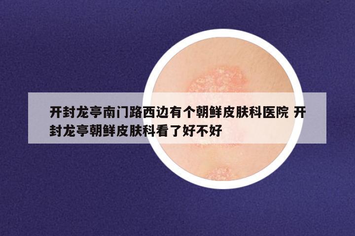 开封龙亭南门路西边有个朝鲜皮肤科医院 开封龙亭朝鲜皮肤科看了好不好