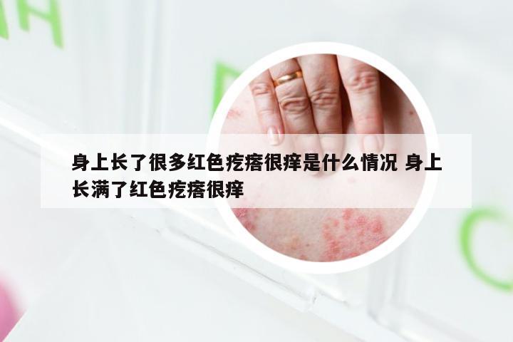 身上长了很多红色疙瘩很痒是什么情况 身上长满了红色疙瘩很痒