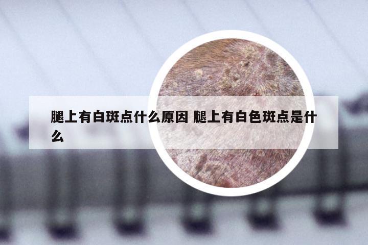 腿上有白斑点什么原因 腿上有白色斑点是什么