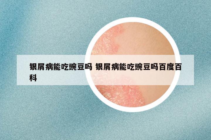 银屑病能吃豌豆吗 银屑病能吃豌豆吗百度百科