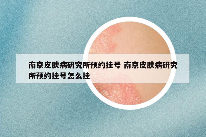 南京皮肤病研究所预约挂号 南京皮肤病研究所预约挂号怎么挂