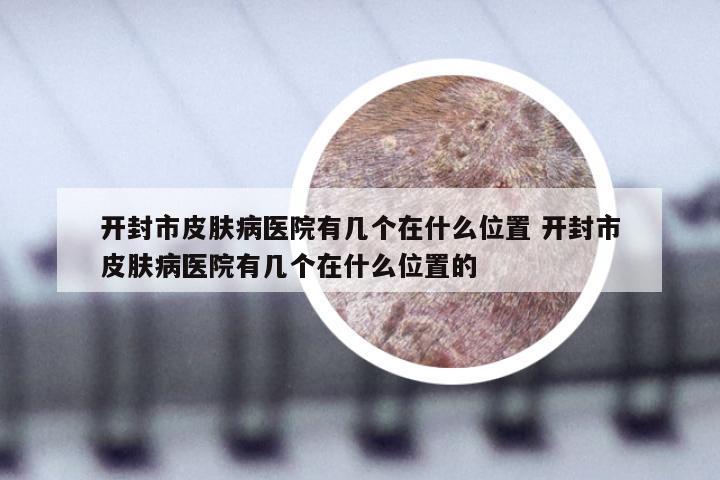 开封市皮肤病医院有几个在什么位置 开封市皮肤病医院有几个在什么位置的