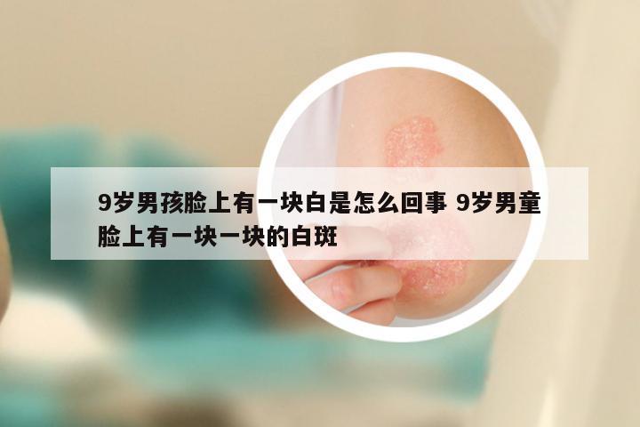 9岁男孩脸上有一块白是怎么回事 9岁男童脸上有一块一块的白斑