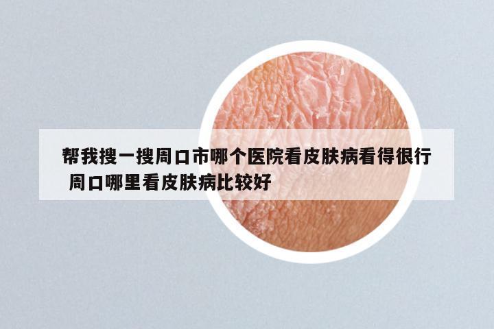 帮我搜一搜周口市哪个医院看皮肤病看得很行 周口哪里看皮肤病比较好
