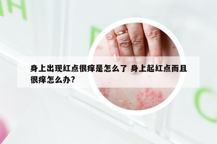 身上出现红点很痒是怎么了 身上起红点而且很痒怎么办?