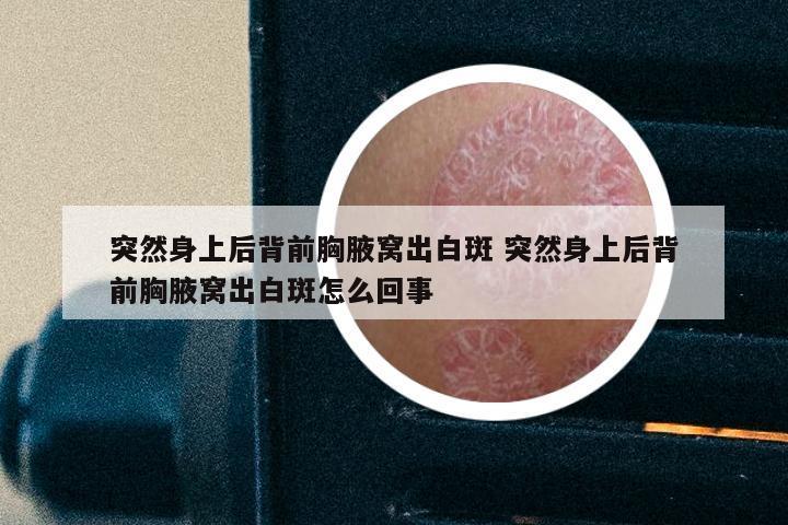 突然身上后背前胸腋窝出白斑 突然身上后背前胸腋窝出白斑怎么回事