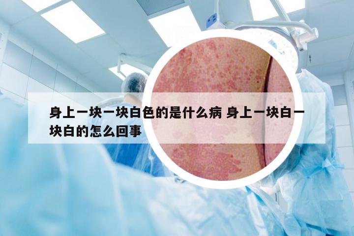 身上一块一块白色的是什么病 身上一块白一块白的怎么回事