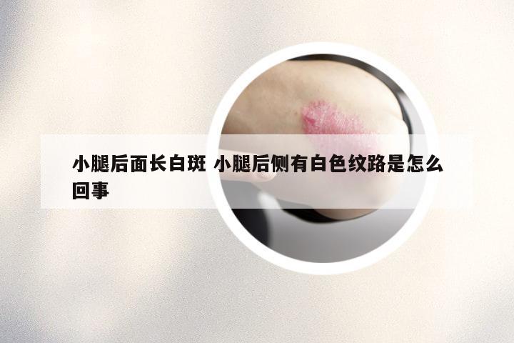 小腿后面长白斑 小腿后侧有白色纹路是怎么回事