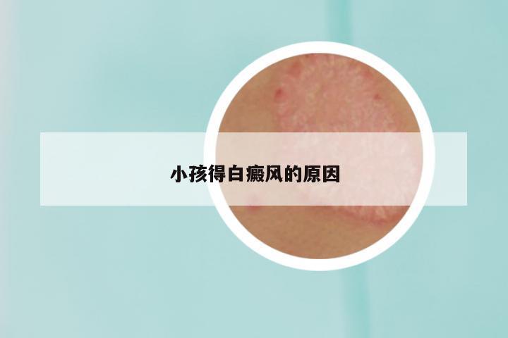 小孩得白癜风的原因