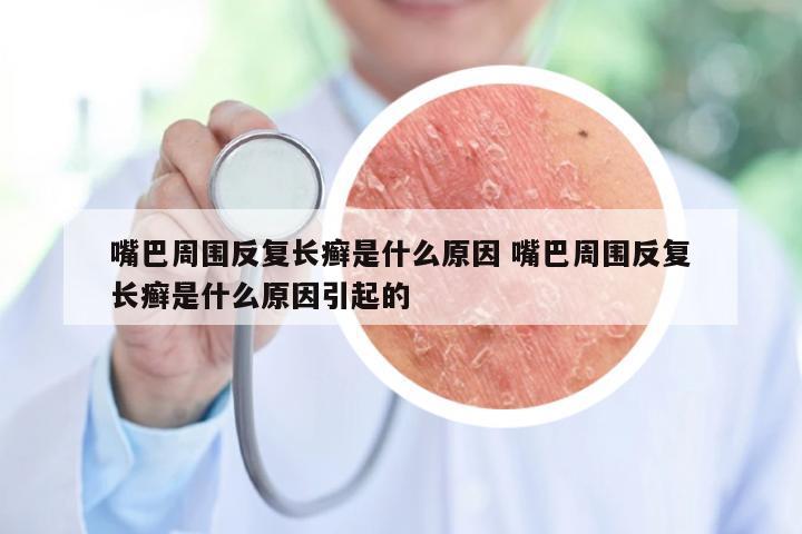 嘴巴周围反复长癣是什么原因 嘴巴周围反复长癣是什么原因引起的