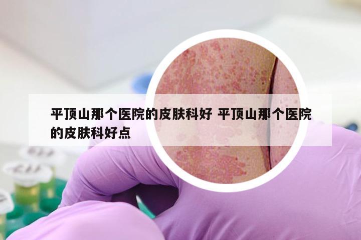 平顶山那个医院的皮肤科好 平顶山那个医院的皮肤科好点