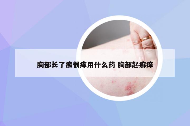 胸部长了癣很痒用什么药 胸部起癣痒