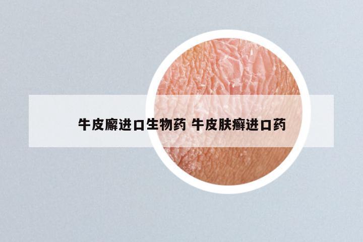 牛皮廨进口生物药 牛皮肤癣进口药