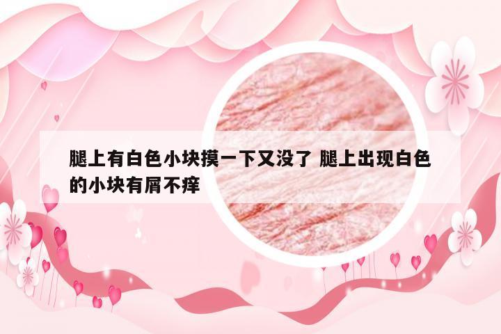 腿上有白色小块摸一下又没了 腿上出现白色的小块有屑不痒