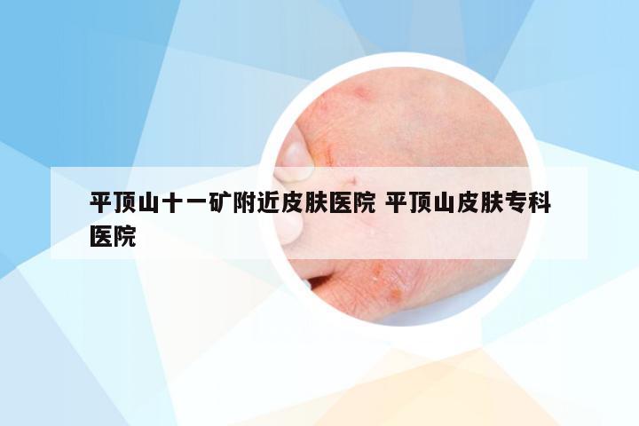 平顶山十一矿附近皮肤医院 平顶山皮肤专科医院