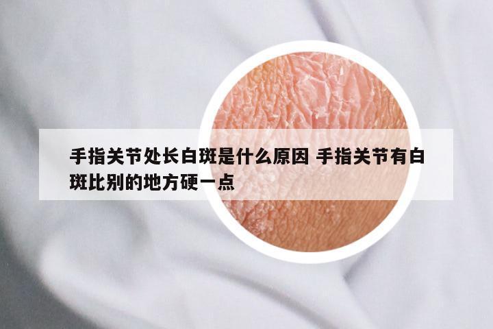 手指关节处长白斑是什么原因 手指关节有白斑比别的地方硬一点