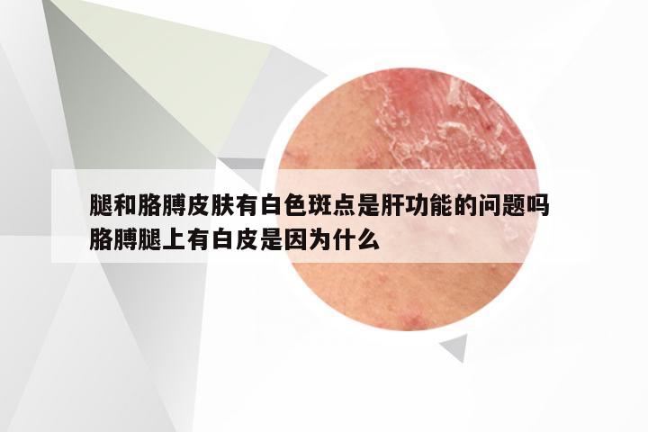 腿和胳膊皮肤有白色斑点是肝功能的问题吗 胳膊腿上有白皮是因为什么