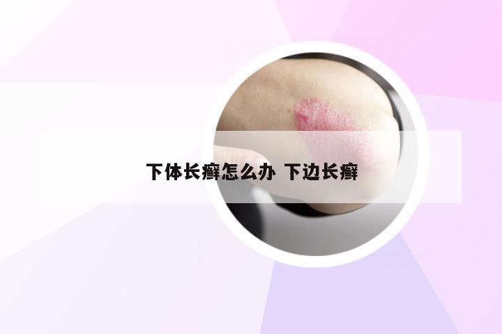 下体长癣怎么办 下边长癣