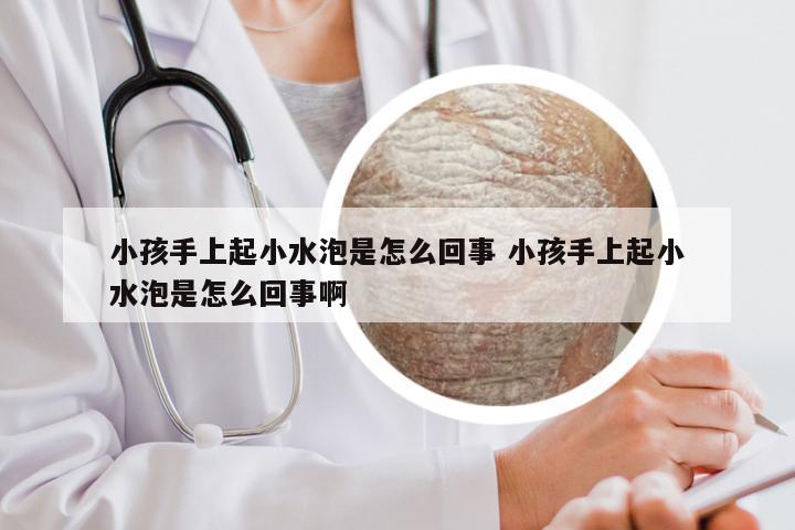 小孩手上起小水泡是怎么回事 小孩手上起小水泡是怎么回事啊