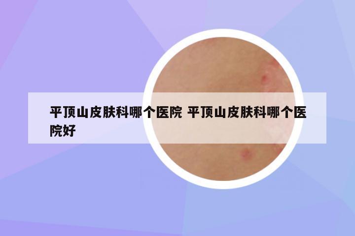 平顶山皮肤科哪个医院 平顶山皮肤科哪个医院好