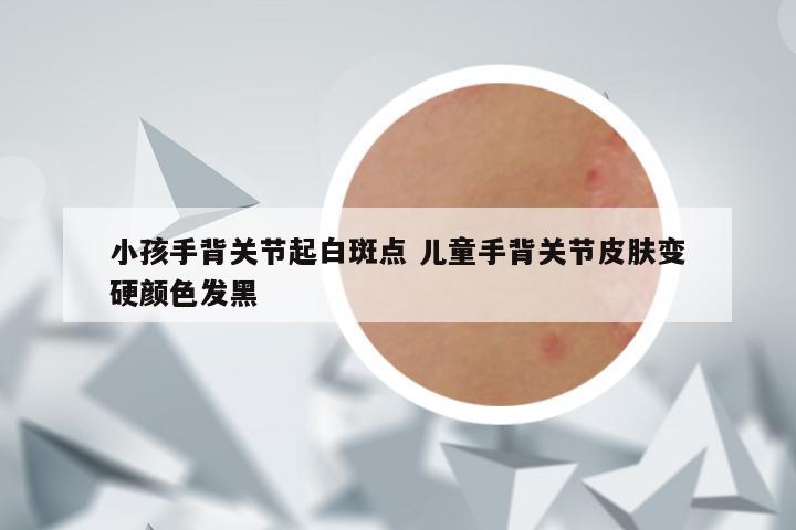 小孩手背关节起白斑点 儿童手背关节皮肤变硬颜色发黑