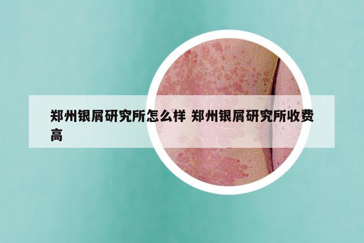 郑州银屑研究所怎么样 郑州银屑研究所收费高