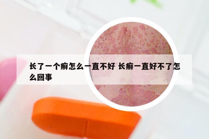 长了一个癣怎么一直不好 长癣一直好不了怎么回事
