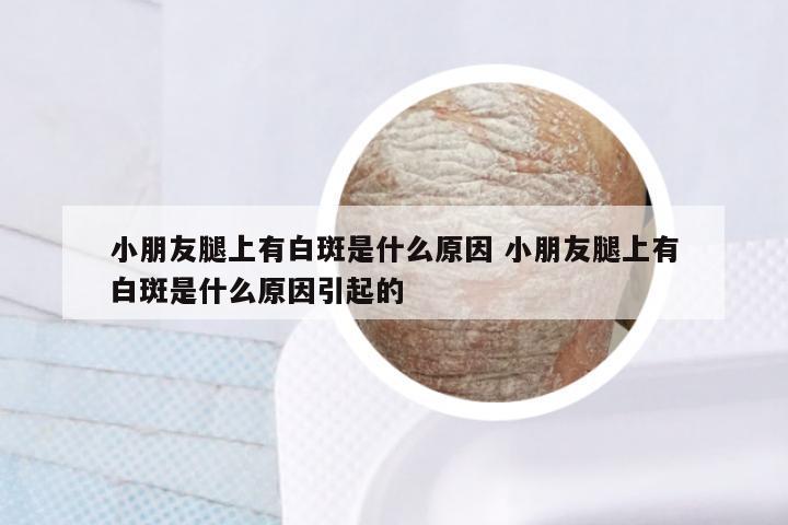 小朋友腿上有白斑是什么原因 小朋友腿上有白斑是什么原因引起的