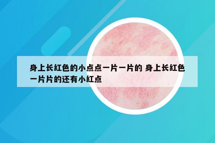身上长红色的小点点一片一片的 身上长红色一片片的还有小红点