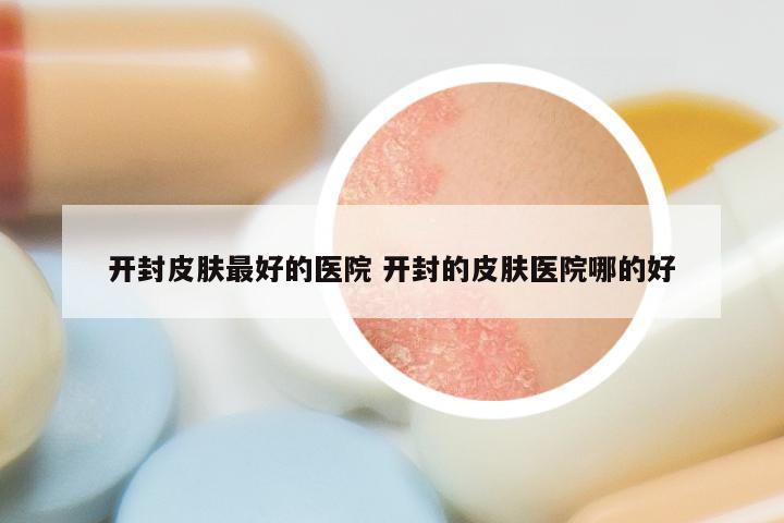 开封皮肤最好的医院 开封的皮肤医院哪的好