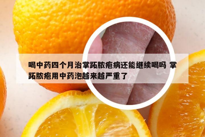 喝中药四个月治掌跖脓疱病还能继续喝吗 掌跖脓疱用中药泡越来越严重了