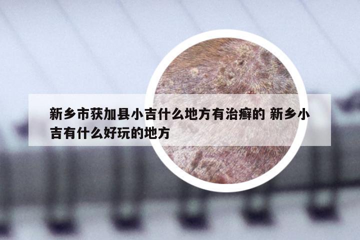 新乡市获加县小吉什么地方有治癣的 新乡小吉有什么好玩的地方