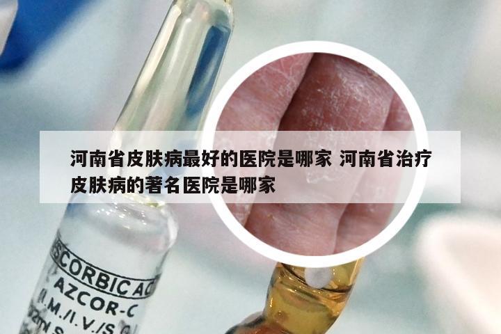 河南省皮肤病最好的医院是哪家 河南省治疗皮肤病的著名医院是哪家