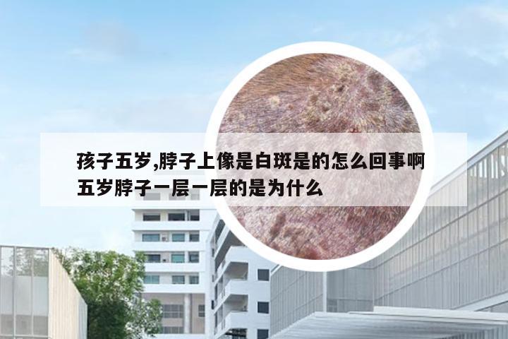 孩子五岁,脖子上像是白斑是的怎么回事啊 五岁脖子一层一层的是为什么