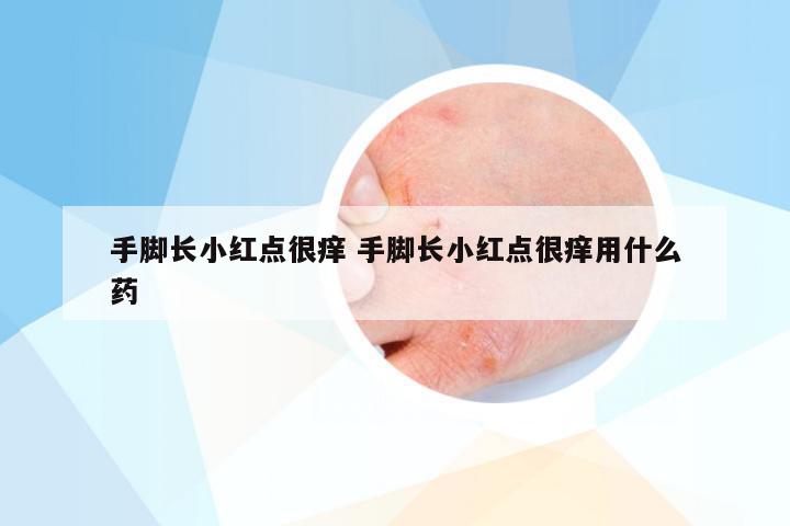 手脚长小红点很痒 手脚长小红点很痒用什么药