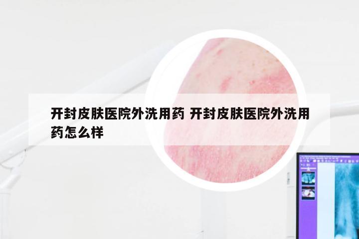 开封皮肤医院外洗用药 开封皮肤医院外洗用药怎么样