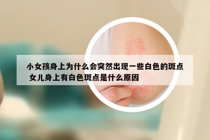 小女孩身上为什么会突然出现一些白色的斑点 女儿身上有白色斑点是什么原因