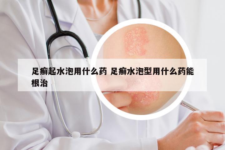 足癣起水泡用什么药 足癣水泡型用什么药能根治