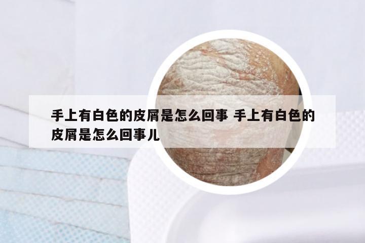 手上有白色的皮屑是怎么回事 手上有白色的皮屑是怎么回事儿