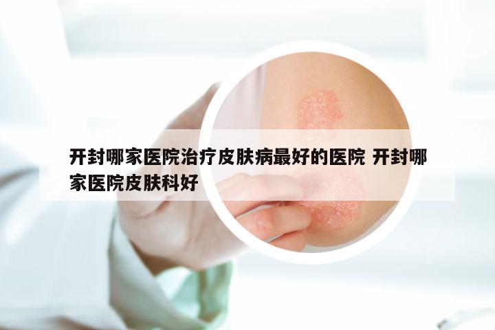 开封哪家医院治疗皮肤病最好的医院 开封哪家医院皮肤科好