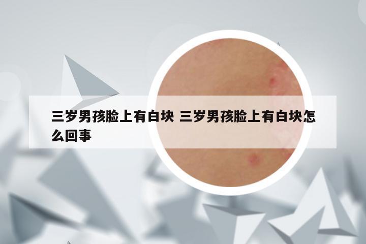 三岁男孩脸上有白块 三岁男孩脸上有白块怎么回事