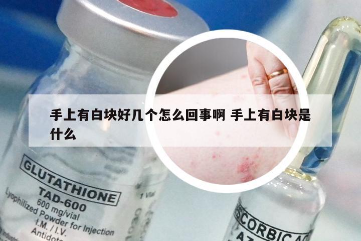 手上有白块好几个怎么回事啊 手上有白块是什么