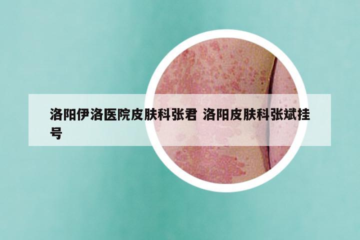 洛阳伊洛医院皮肤科张君 洛阳皮肤科张斌挂号