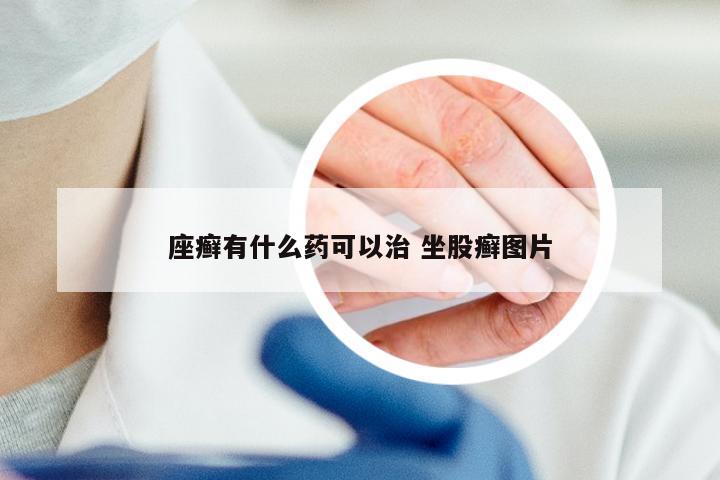 座癣有什么药可以治 坐股癣图片