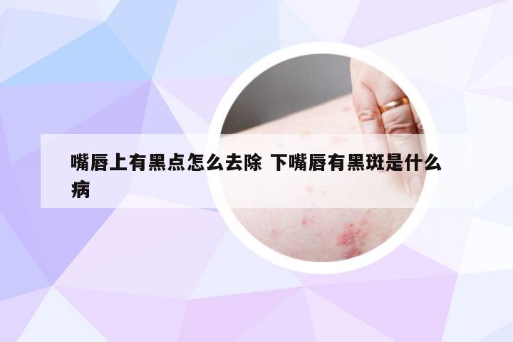 嘴唇上有黑点怎么去除 下嘴唇有黑斑是什么病