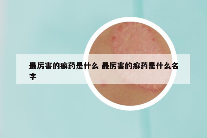 最厉害的癣药是什么 最厉害的癣药是什么名字
