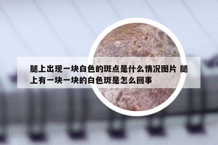 腿上出现一块白色的斑点是什么情况图片 腿上有一块一块的白色斑是怎么回事