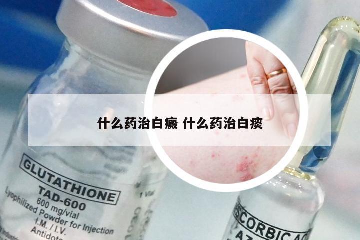 什么药治白癜 什么药治白痰